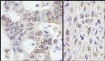 PRKRIR Antibody in Immunohistochemistry (IHC)