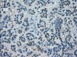 PRKY Antibody in Immunohistochemistry (Paraffin) (IHC (P))