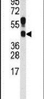 PRMT1 Antibody in Western Blot (WB)