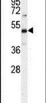 PRMT1 Antibody in Western Blot (WB)