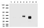 PROCR Antibody in Western Blot (WB)