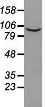 PROM2 Antibody in Western Blot (WB)