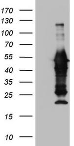 PRPH Antibody in Western Blot (WB)