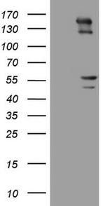 PRPH Antibody in Western Blot (WB)