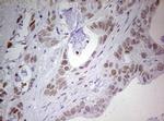 PRRX1 Antibody in Immunohistochemistry (Paraffin) (IHC (P))