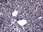 PRRX1 Antibody in Immunohistochemistry (Paraffin) (IHC (P))