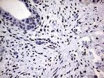 PRRX1 Antibody in Immunohistochemistry (Paraffin) (IHC (P))