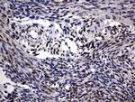 PRRX1 Antibody in Immunohistochemistry (Paraffin) (IHC (P))