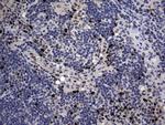 PRRX1 Antibody in Immunohistochemistry (Paraffin) (IHC (P))