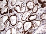 PRRX1 Antibody in Immunohistochemistry (Paraffin) (IHC (P))