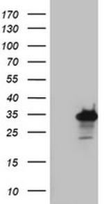 PRRX1 Antibody in Western Blot (WB)