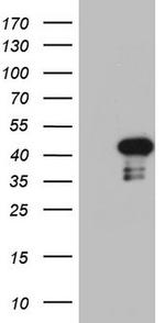 PRRX1 Antibody in Western Blot (WB)