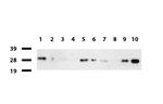 PSMA6 Antibody in Western Blot (WB)