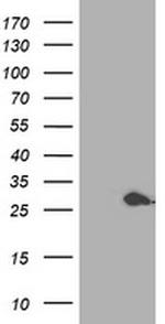 PSMB4 Antibody in Western Blot (WB)