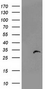 PSMB4 Antibody in Western Blot (WB)