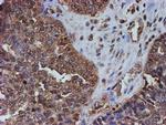 PSMB9 Antibody in Immunohistochemistry (Paraffin) (IHC (P))