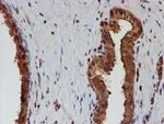 PSMB9 Antibody in Immunohistochemistry (Paraffin) (IHC (P))