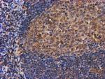 PSMB9 Antibody in Immunohistochemistry (Paraffin) (IHC (P))