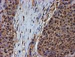 PSMB9 Antibody in Immunohistochemistry (Paraffin) (IHC (P))