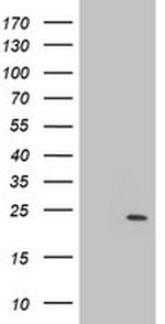 PSMB9 Antibody in Western Blot (WB)