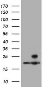 PSMB9 Antibody in Western Blot (WB)