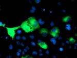 PSMD2 Antibody in Immunocytochemistry (ICC/IF)