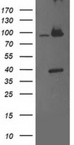 PSMD2 Antibody in Western Blot (WB)