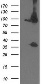 PSMD2 Antibody in Western Blot (WB)