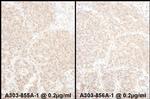 PSMD4 Antibody in Immunohistochemistry (IHC)