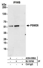 PSMD5/26S Proteasome Subunit S5B Antibody in Western Blot (WB)