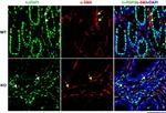 PTBP1 Antibody in Immunocytochemistry (ICC/IF)