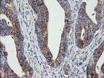 PTGES2 Antibody in Immunohistochemistry (Paraffin) (IHC (P))