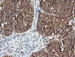 PTK2 Antibody in Immunohistochemistry (Paraffin) (IHC (P))