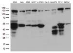 PTK2 Antibody in Western Blot (WB)