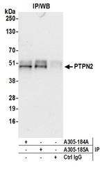 PTPN2/TCPTP Antibody in Western Blot (WB)
