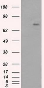 PTPRE Antibody in Western Blot (WB)