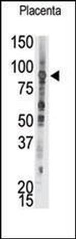 PTPRE Antibody in Western Blot (WB)