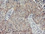 PVRL1 Antibody in Immunohistochemistry (Paraffin) (IHC (P))