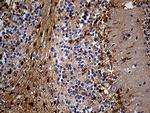 PYGM Antibody in Immunohistochemistry (Paraffin) (IHC (P))