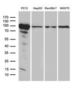 PYGM Antibody in Western Blot (WB)