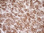 Pan-CDH Antibody in Immunohistochemistry (Paraffin) (IHC (P))