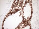 Pan-CDH Antibody in Immunohistochemistry (Paraffin) (IHC (P))