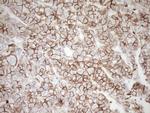 Pan-CDH Antibody in Immunohistochemistry (Paraffin) (IHC (P))