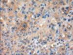 Patched1 Antibody in Immunohistochemistry (Paraffin) (IHC (P))