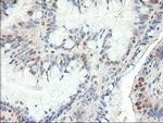 Patched1 Antibody in Immunohistochemistry (Paraffin) (IHC (P))