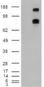 Patched1 Antibody in Western Blot (WB)