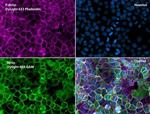 Phalloidin Control in Immunocytochemistry (ICC/IF)