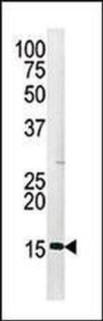 Phospho-Histone H3 (Ser28) Antibody in Western Blot (WB)