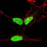 Phospho-KLF4 (Ser245) Antibody in Immunocytochemistry (ICC/IF)