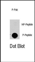 Phospho-HPK1 (Thr165) Antibody in Dot Blot (DB)